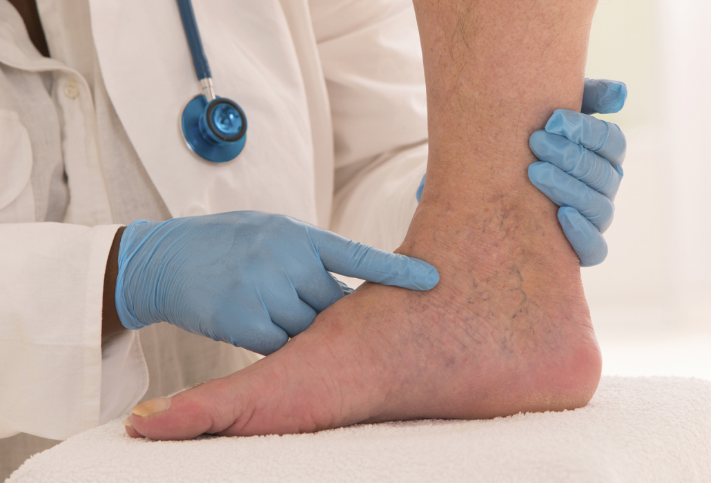 When To See A Vascular Doctor: What Does A Vein Clinic Do?