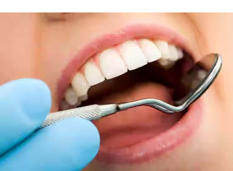 dental extraction