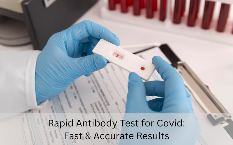 Rapid antibody test for Covid