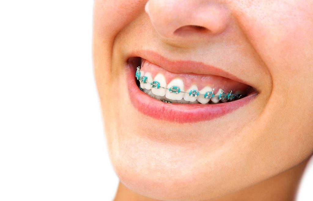 miami shores orthodontist